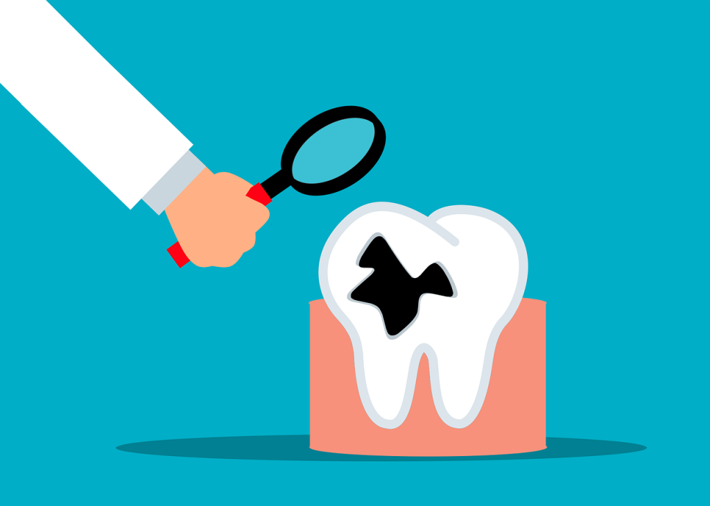 tooth decay, dentist, dental
