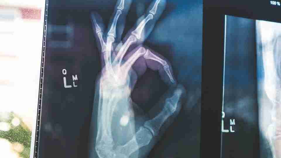 X-ray scan of a hand