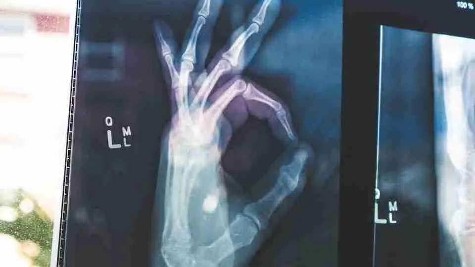 X-ray scan of a hand