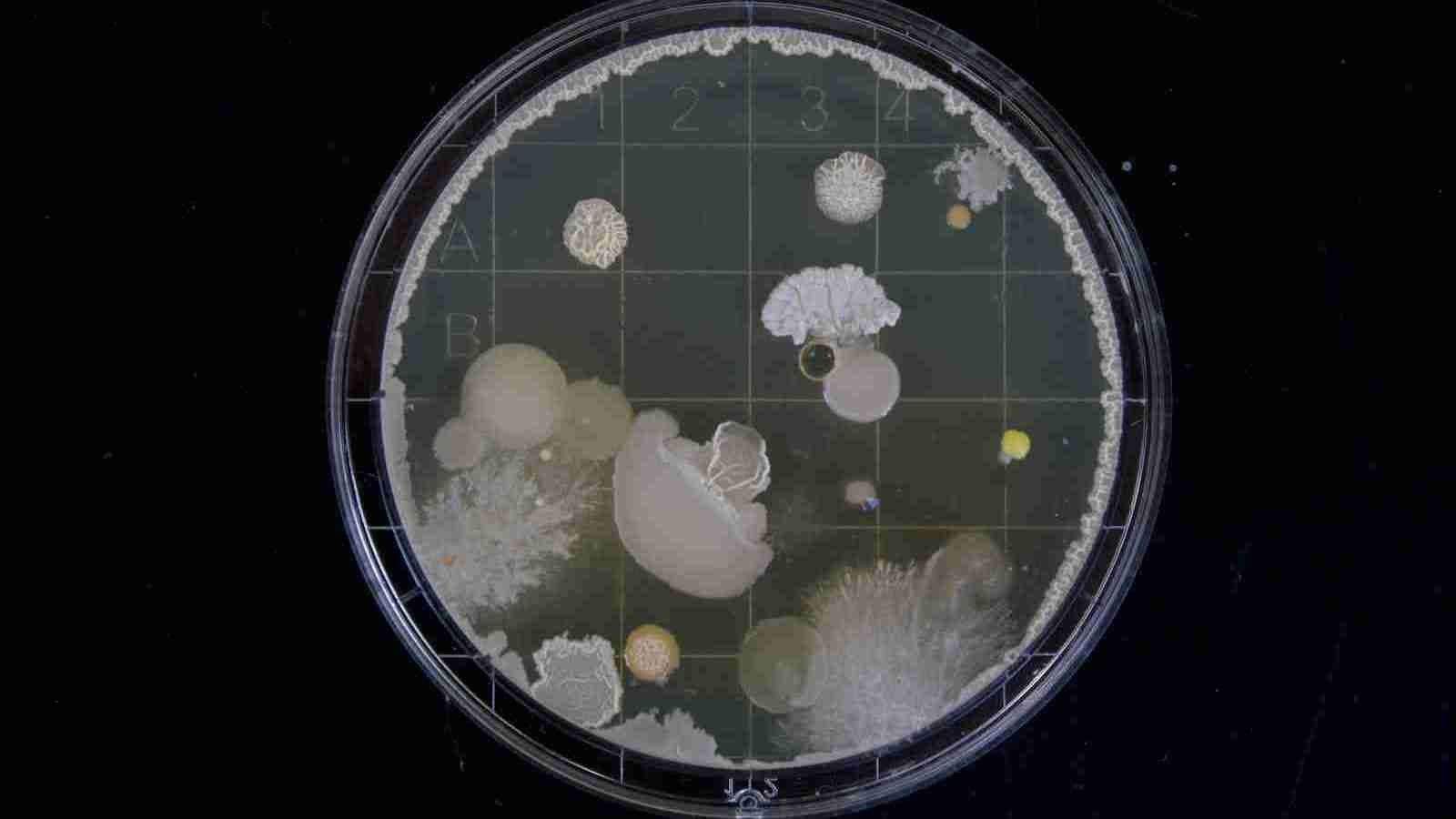 microscopic image of a bacteria culture